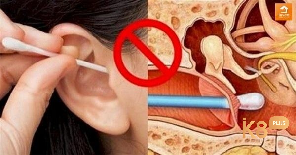 Ngứa tai là hiện tượng phổ biến mà nhiều người gặp phải